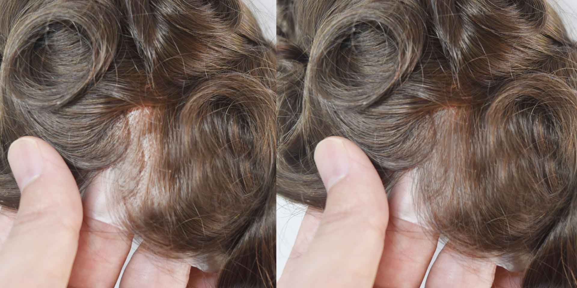 Hairpieces