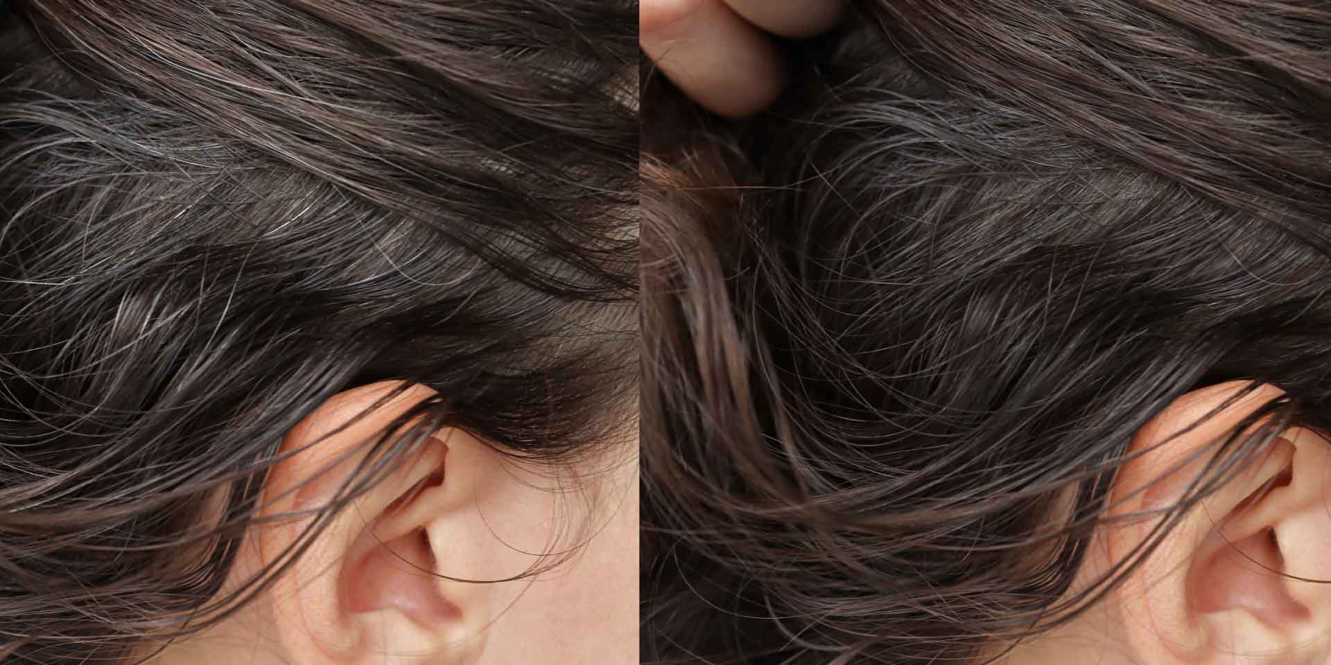 Grey hair