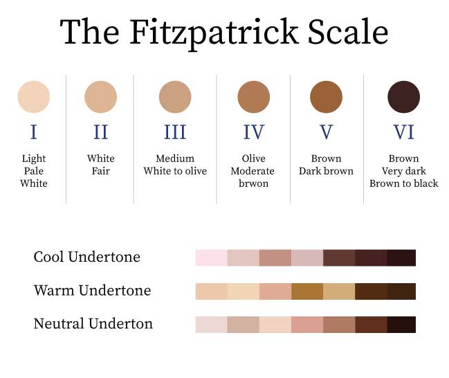 fitzpatrick