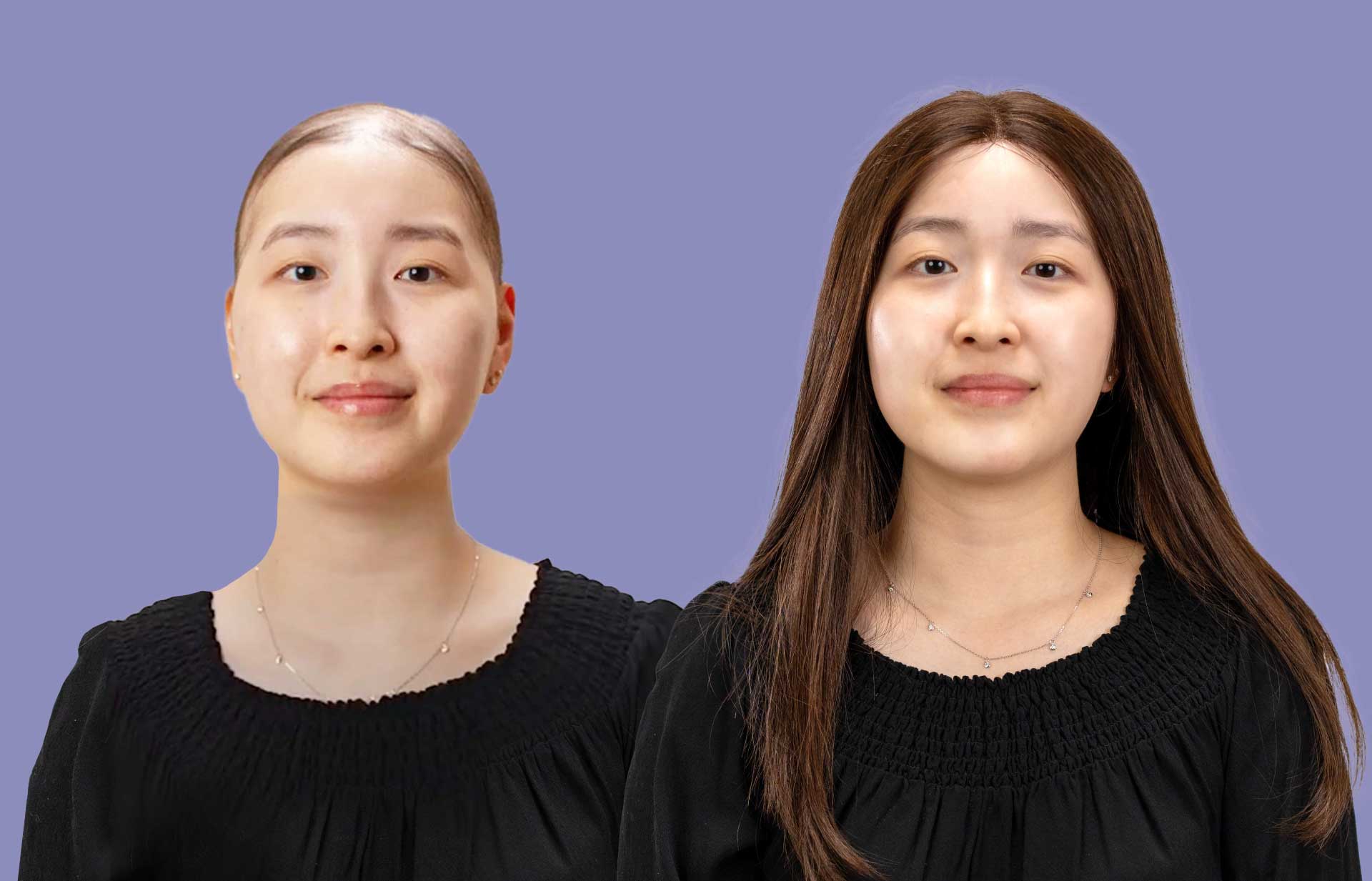 medical wig